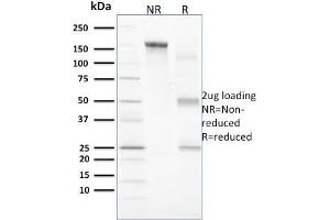 SDS-PAGE Analysis Purified Vinculin Mouse Monoclonal Antibody (VCL/2573). (Vinculin anticorps  (AA 174-322))