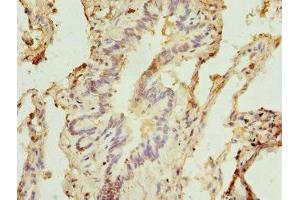 Immunohistochemistry of paraffin-embedded human lung tissue using ABIN7171242 at dilution of 1:100 (Syntaxin 5 anticorps  (AA 55-355))