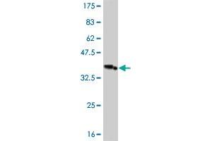 Western Blot detection against Immunogen (36. (IRAK3 anticorps  (AA 497-596))