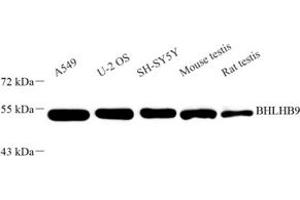 Western blot analysis of BHLHB9 (ABIN7073183) at dilution of 1: 1000 (BHLHB9 anticorps)