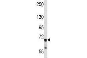 IL1R1 antibody western blot analysis in mouse liver tissue lysate (IL1R1 anticorps  (AA 422-450))