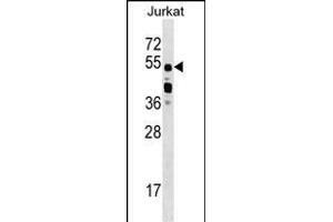 CUGBP2 Antibody (C-term) (ABIN1537389 and ABIN2848868) western blot analysis in Jurkat cell line lysates (35 μg/lane). (CELF2 anticorps  (C-Term))