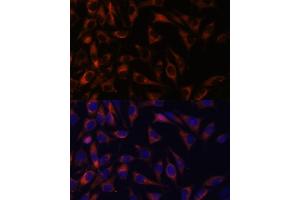 Immunofluorescence analysis of L929 cells using WFDC1 antibody (ABIN7271344) at dilution of 1:100.