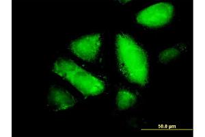 Immunofluorescence of monoclonal antibody to GSTZ1 on HepG2 cell.