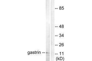 Western blot analysis of extracts from NIH/3T3 cells, using Gastrin antibody. (Gastrin anticorps)