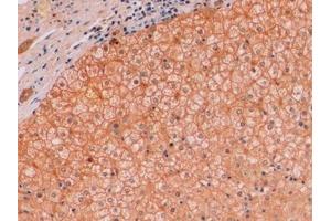 Detection of β-catenin in Human Liver Tissue using Monoclonal Antibody to Beta Catenin (β-catenin)