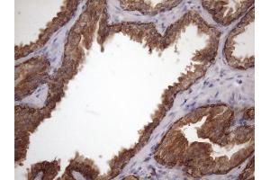 Immunohistochemistry (IHC) image for anti-Amelotin (AMTN) antibody (ABIN2716038)