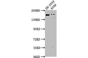 Western Blot Positive WB detected in: SH-SY5Y whole cell lysate, A549 whole cell lysate All lanes: GLI2 antibody at 1:1000 Secondary Goat polyclonal to rabbit IgG at 1/50000 dilution Predicted band size: 168, 134, 132, 89, 87 kDa Observed band size: 168 kDa (GLI2 anticorps  (AA 2-20))