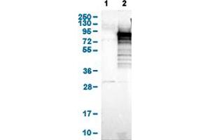 Western Blot analysis of (1) Negative control (vector only transfected HEK293T lysate), and (2) Over-expression lysate (Co-expressed with a C-terminal myc-DDK tag (~3. (Adenylate Kinase 5 anticorps  (AA 318-398))