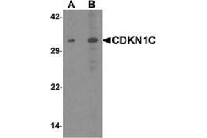 Western blot analysis of CDKN1C in 293 cell lysate with CDKN1C Antibody  at (A) 1 and (B) 2 μg/ml. (CDKN1C anticorps  (N-Term))