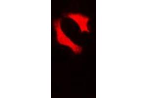 Immunofluorescent analysis of p53 staining in HepG2 cells. (p53 anticorps  (C-Term))