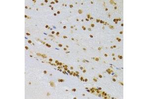 Immunohistochemistry of paraffin-embedded rat brain using HMGB1 Antibody. (HMGB1 anticorps  (AA 100-200))