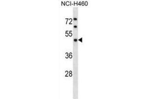 Western Blotting (WB) image for anti-Kaptin (Actin Binding Protein) (KPTN) antibody (ABIN2998936) (KPTN anticorps)