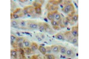 Used in DAB staining on fromalin fixed paraffin-embedded Liver tissue