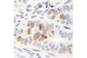 Immunohistochemistry (IHC) image for anti-Nanog Homeobox (NANOG) (AA 1-50) antibody (ABIN7448679)
