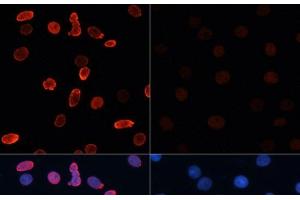 Immunofluorescence analysis of C6 cells using Acetyl-Histone H2B-K15 Polyclonal Antibody at dilution of 1:100.