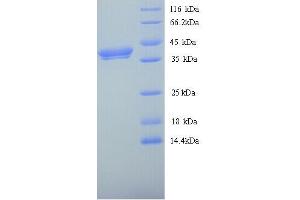 SDS-PAGE (SDS) image for Wingless-Type MMTV Integration Site Family, Member 8A (WNT8A) (AA 23-358) protein (His tag) (ABIN5714118)