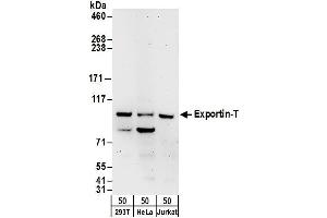 Western Blotting (WB) image for anti-Exportin, tRNA (Nuclear Export Receptor For TRNAs) (XPOT) (AA 912-962) antibody (ABIN7449731)
