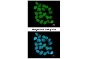 ICC/IF Image Immunofluorescence analysis of paraformaldehyde-fixed A431, using Bloom syndrome protein, antibody at 1:200 dilution. (BLM anticorps  (C-Term))