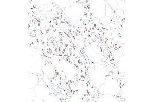 Immunohistochemistry (IHC) image for anti-Interferon, gamma-Inducible Protein 16 (IFI16) (AA 350-400) antibody (ABIN7795821)