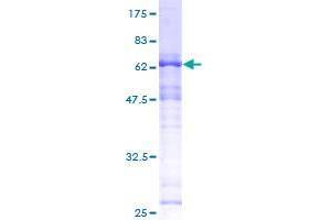 Image no. 1 for SAP30 Binding Protein (SAP30BP) (AA 1-308) protein (GST tag) (ABIN1319150)