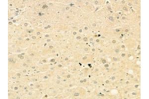 ABIN6263270 and ABIN6268834 at 1/100 staining human normal liver tissue by IHC-P.