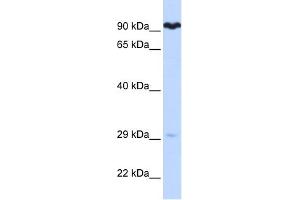 SUPV3L1 antibody used at 1 ug/ml to detect target protein. (SUPV3L1 anticorps)