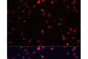 Immunofluorescence analysis of C6 cells using c-Fos Polyclonal Antibody at dilution of 1:100.