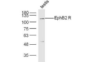 Mouse testis lysates probed with Rabbit Anti-EphB2 R Polyclonal Antibody, Unconjugated  at 1:300 overnight at 4˚C. (EphB2 R (AA 101-200) anticorps)