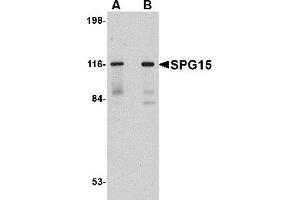 Western Blotting (WB) image for anti-Zinc Finger, FYVE Domain Containing 26 (ZFYVE26) (C-Term) antibody (ABIN1030693) (ZFYVE26 anticorps  (C-Term))