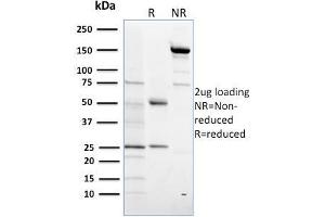 SDS-PAGE Analysis Purified SULT1E1 Mouse Monoclonal Antibody (CPTC-SULT1E1-1).