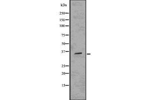 Western blot analysis SIX2 using HUVEC whole cell lysates (SIX2 anticorps  (Internal Region))