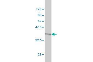 Western Blot detection against Immunogen (37.