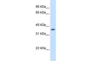 Western Blotting (WB) image for anti-Aldo-Keto Reductase Family 1, Member B10 (Aldose Reductase) (AKR1B10) antibody (ABIN2462603) (AKR1B10 anticorps)