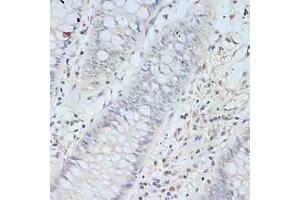 Immunohistochemistry of paraffin-embedded human colon using TCEB2 antibody (ABIN6131621, ABIN6148934, ABIN6148936 and ABIN6217328) at dilution of 1:100 (40x lens). (TCEB2 anticorps  (AA 1-118))