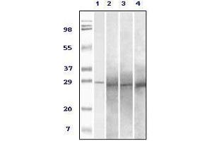 Western blot analysis using Rab25 mouse mAb against truncated Rab25 recombinant protein (1), human overy carcinoma(2), stomach carcinoma (3), breast carcinoma (4) tissue lysate. (RAB25 anticorps)