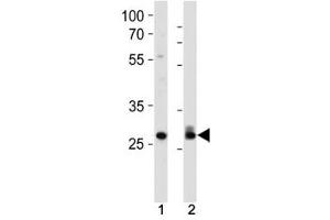 Cdk2 antibody western blot analysis in 293, HeLa lysate.