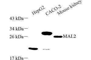 Western blot analysis of MAL2 (ABIN7074549) at dilution of 1: 500