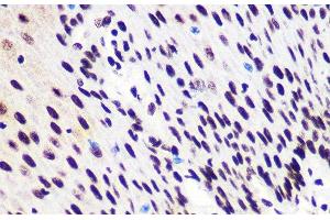 Immunohistochemistry of paraffin-embedded Human esophagus using Phospho-Smad2(S465/467)/Smad3(S423/425) Polyclonal Antibody at dilution of 1:100 (40x lens).