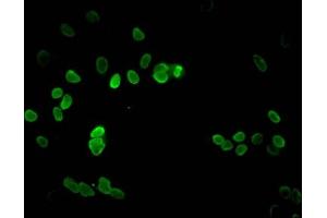 Immunofluorescent analysis of Hela cells using ABIN7139282 at dilution of 1:100 and Alexa Fluor 488-congugated AffiniPure Goat Anti-Rabbit IgG(H+L) (HIST1H3A anticorps  (H3K9me2))