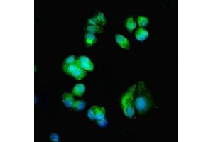 Immunofluorescent analysis of MCF-7 cells using ABIN7175612 at dilution of 1:100 and Alexa Fluor 488-congugated AffiniPure Goat Anti-Rabbit IgG(H+L) (CACNA1H anticorps  (AA 260-360))