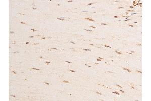 ABIN6267289 at 1/100 staining human gastric tissue sections by IHC-P.