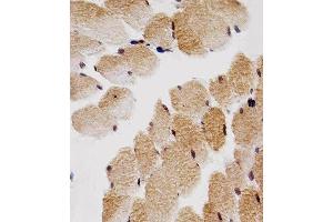 Paraformaldehyde-fixed, paraffin embedded human skeletal muscle tissue, Antigen retrieval by boiling in sodium citrate buffer (pH6. (CDKN1B anticorps)