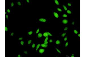 Immunofluorescence of purified MaxPab antibody to RNF25 on HeLa cell.
