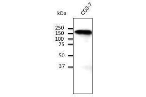 Endogenous CD45 detected With ABOIOO at 1/500 dilution, lysate at 100 µg per Iane and rabbit polyclonal to goat lµg (HRP) at 2/10,000 dilution, (E-cadherin anticorps)
