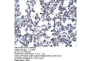 Human Lung (GCM1 anticorps  (N-Term))