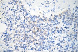 anti-Amyloid beta (A4) Precursor-Like Protein 2 (APLP2) antibody