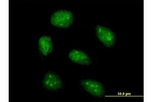 Immunofluorescence of purified MaxPab antibody to AIM2 on HeLa cell. (AIM2 anticorps  (AA 1-343))