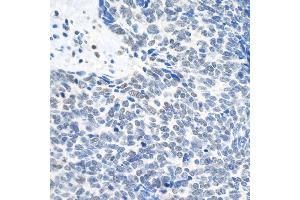 anti-Topoisomerase (DNA) II beta 180kDa (TOP2B) (C-Term) antibody