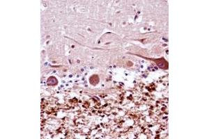 anti-Fanconi Anemia Complementation Group G (FANCG) (AA 539-568), (C-Term) antibody